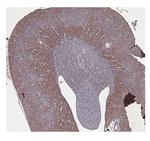 CBS Polyclonal Antibody