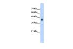 USP16 Antibody in Western Blot (WB)