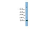 TFF1 Antibody in Western Blot (WB)