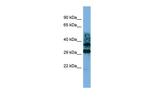 CRYZL1 Polyclonal Antibody