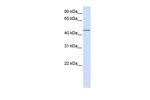 PARVB Polyclonal Antibody
