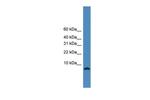 KIAA0101 Polyclonal Antibody