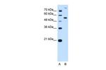 PPAT Antibody in Western Blot (WB)
