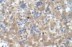 PEX3 Polyclonal Antibody