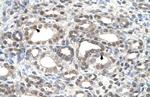 DFNA5 Polyclonal Antibody