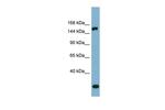 EPRS Polyclonal Antibody