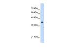 PDSS1 Polyclonal Antibody