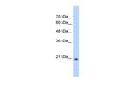 GINS2 Polyclonal Antibody