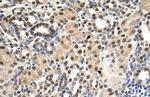 PHAP III Polyclonal Antibody