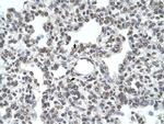 TMPRSS11D Antibody in Immunohistochemistry (IHC)