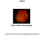 ACSL3 Polyclonal Antibody