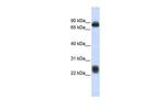 TSPAN8 Polyclonal Antibody