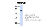 MMP20 Polyclonal Antibody