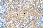 TSPAN5 Polyclonal Antibody