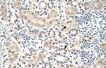 ST8SIA2 Polyclonal Antibody