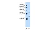 ST8SIA2 Antibody in Western Blot (WB)