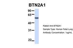 BTN2A1 Antibody in Western Blot (WB)