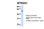 BTN2A1 Antibody in Western Blot (WB)