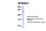 BTN2A1 Polyclonal Antibody