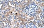 GALNT6 Antibody in Immunohistochemistry (IHC)