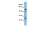 LAMP5 Polyclonal Antibody