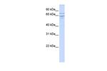 EDEM1 Polyclonal Antibody