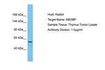 ABI3BP Polyclonal Antibody