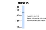 CHST15 Antibody in Western Blot (WB)