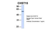 CHST15 Polyclonal Antibody