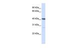 DNAJB11 Polyclonal Antibody