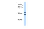 GDE1 Antibody in Western Blot (WB)