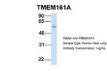 TMEM161A Antibody in Western Blot (WB)