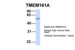 TMEM161A Antibody in Western Blot (WB)