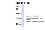 TMEM161A Antibody in Western Blot (WB)