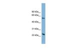 TMEM161A Polyclonal Antibody