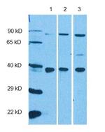RHBDL2 Polyclonal Antibody