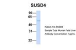 SUSD4 Polyclonal Antibody