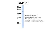 TMEM16K Polyclonal Antibody