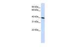 CARKD Polyclonal Antibody