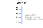 ZNF131 Antibody in Western Blot (WB)