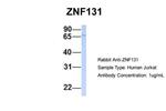 ZNF131 Antibody in Western Blot (WB)