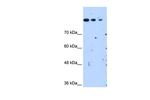 SETD2 Antibody in Western Blot (WB)