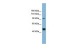 MAML3 Polyclonal Antibody