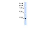 UXT Polyclonal Antibody