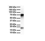 APEH Antibody in Western Blot (WB)