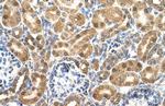 ENO3 Polyclonal Antibody