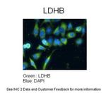 LDHB Polyclonal Antibody