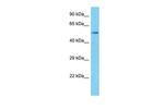 SPARCL1 Polyclonal Antibody