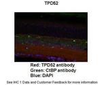 TPD52 Antibody in Immunohistochemistry (IHC)
