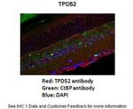 TPD52 Antibody in Immunohistochemistry (IHC)